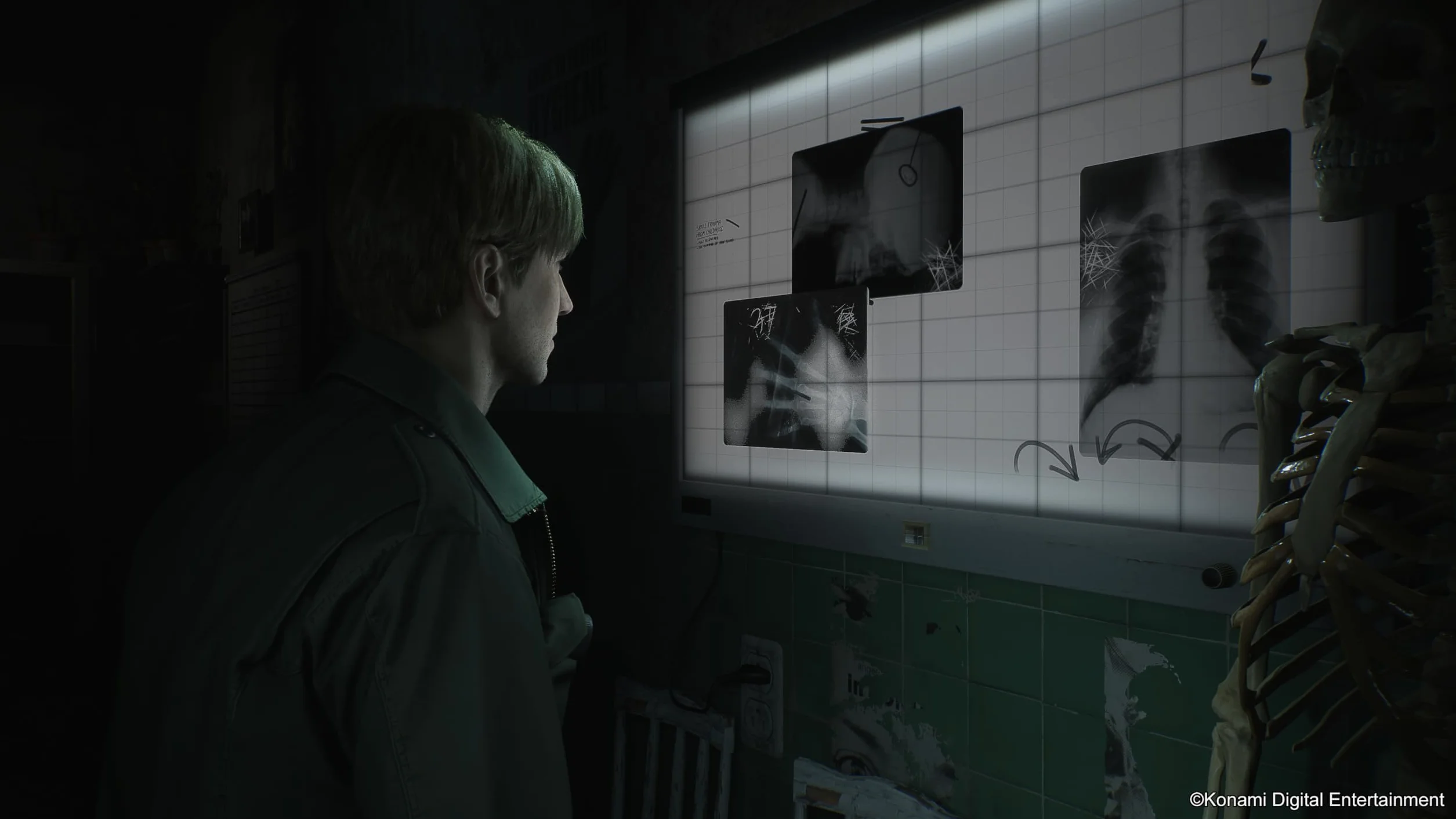 Silent Hill 2 - PS5